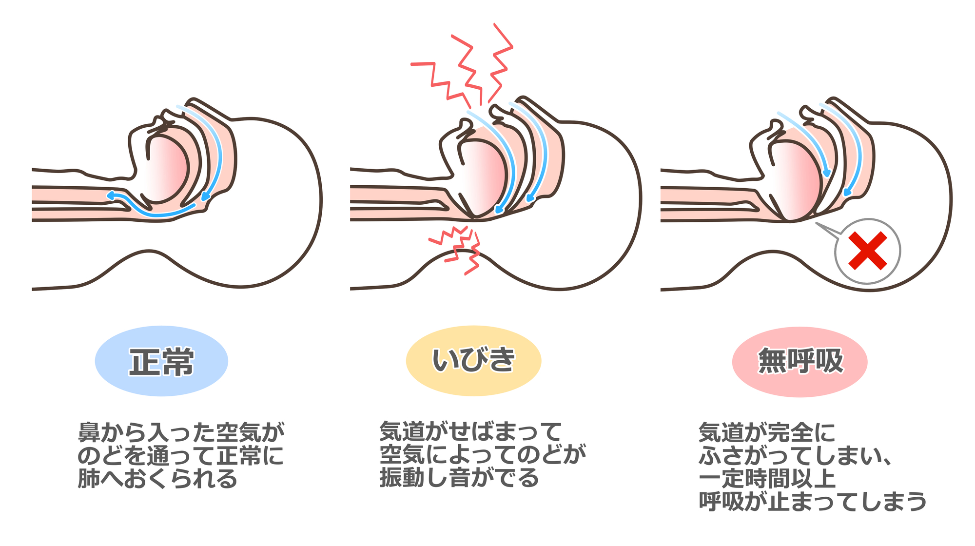 しみず歯科｜雪が谷大塚（大田区南雪谷）の歯医者、しみず歯科の態癖（よくない生活習慣）